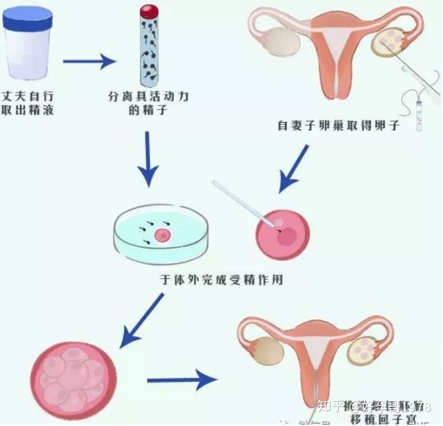青岛赠卵试管婴儿｜胚胎质量影响赠卵试管婴儿的问题有哪些？