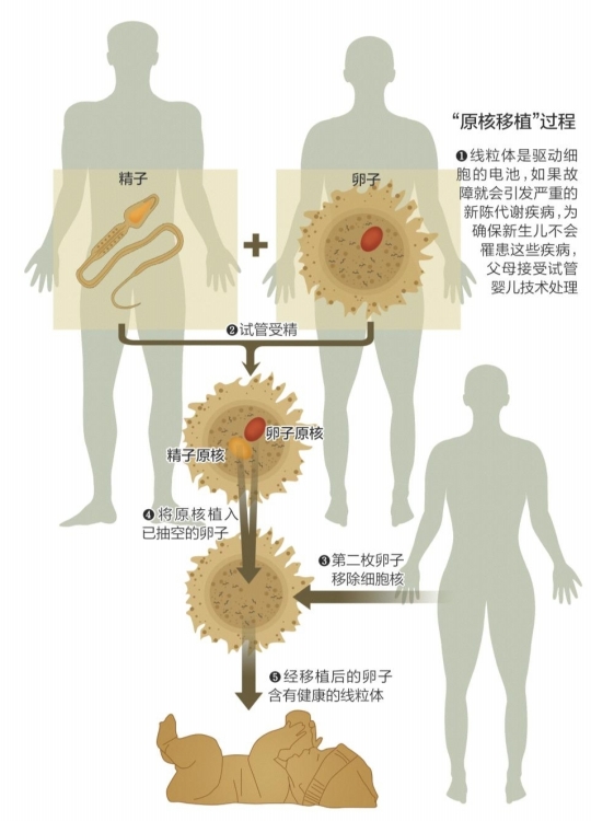湖南供卵是多少钱,微信ZYZX湖南供卵是多少钱湖南供卵是多少钱.KTP