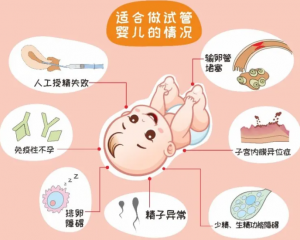 北医三院试管最牛专家