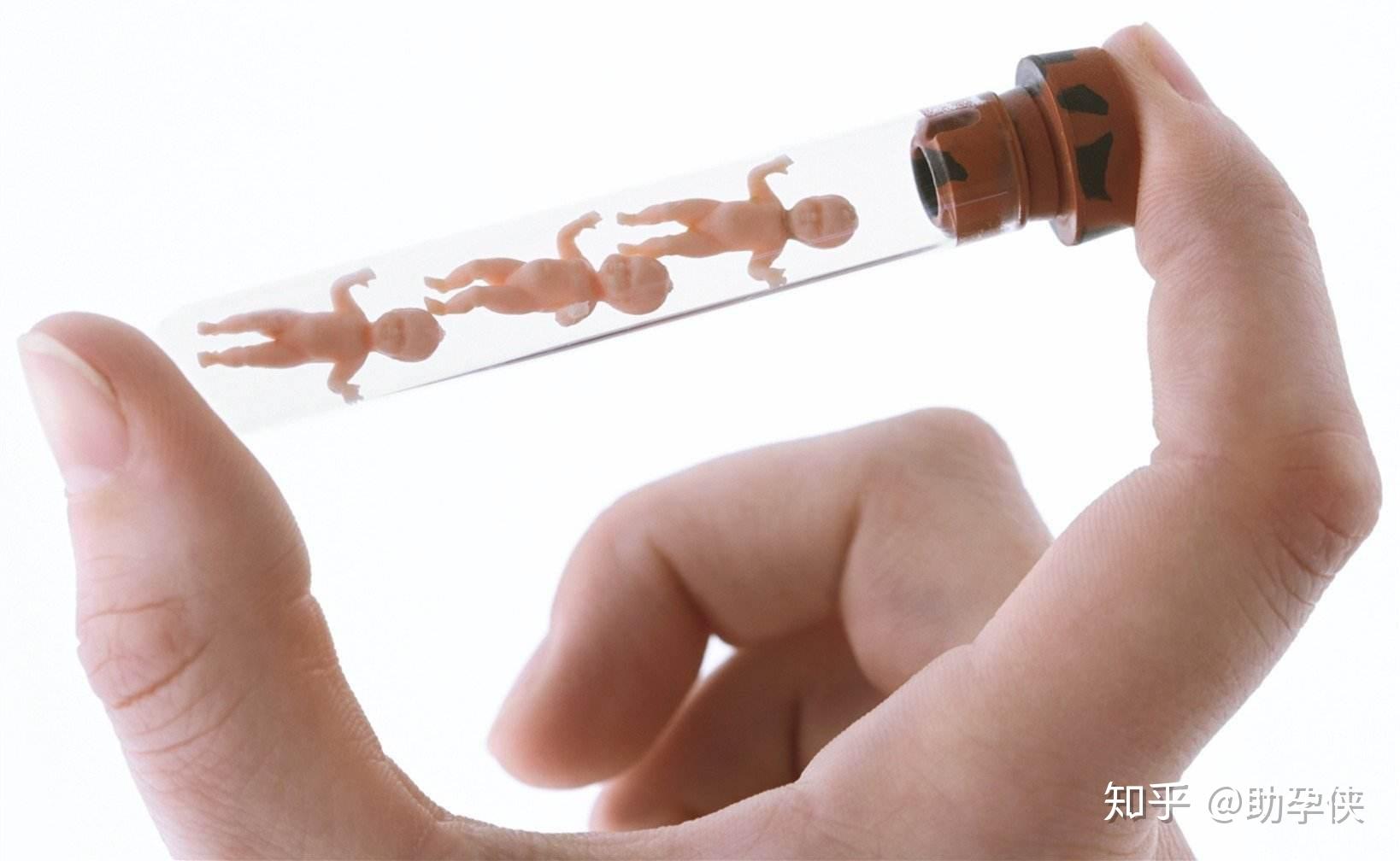 卵巢多囊能自然怀孕吗,多囊卵巢是怎么回事